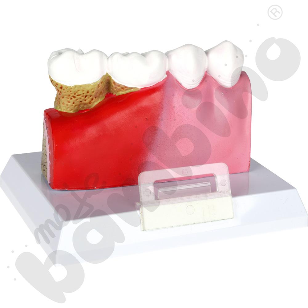 Model podstawowych patologii zębów