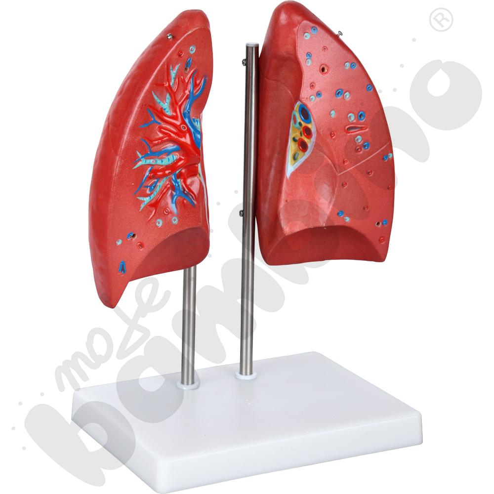 Model płuc rozkładany